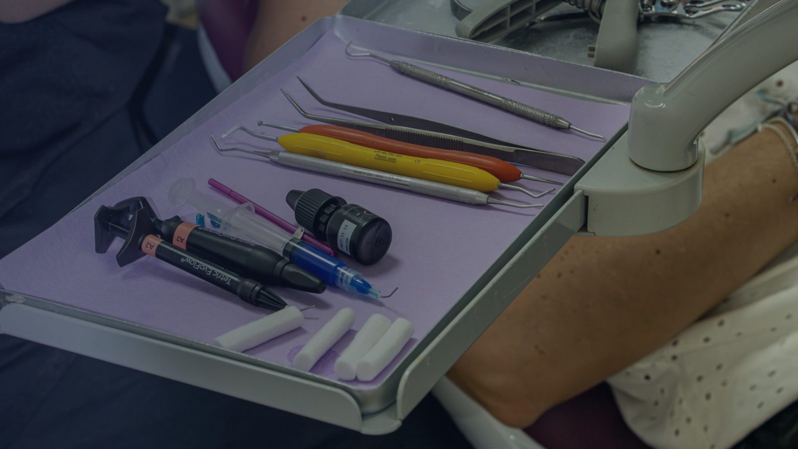 Qué es la caries, cómo avanza y cuándo hay que tratarla