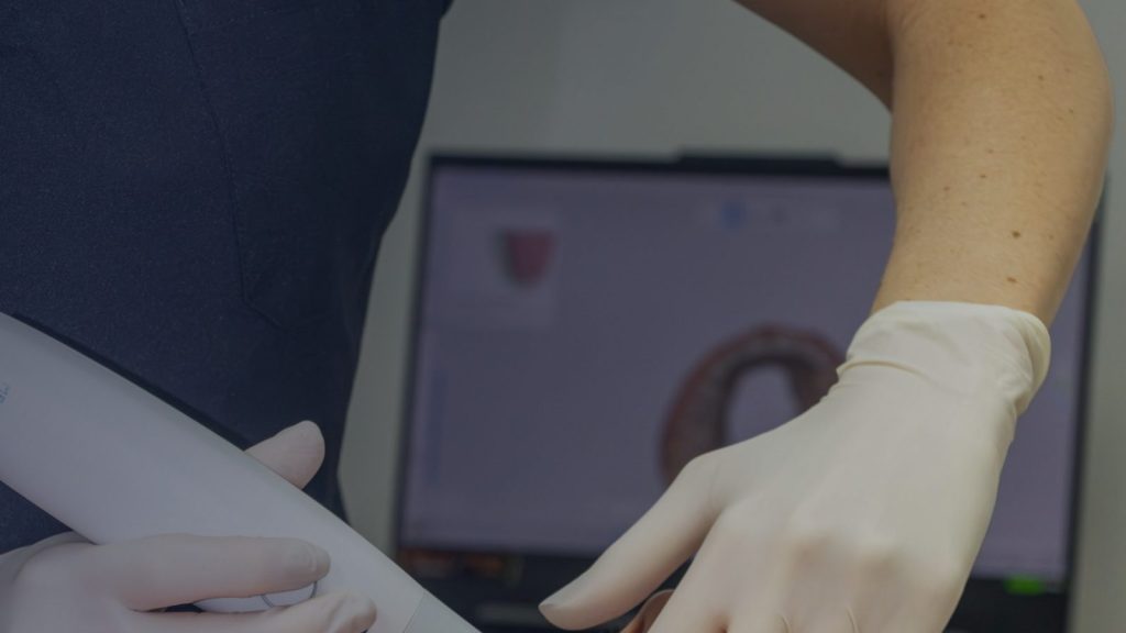 Impresión digital con escáner intraoral para una corona de zirconio en Clínica Dental Miriam García