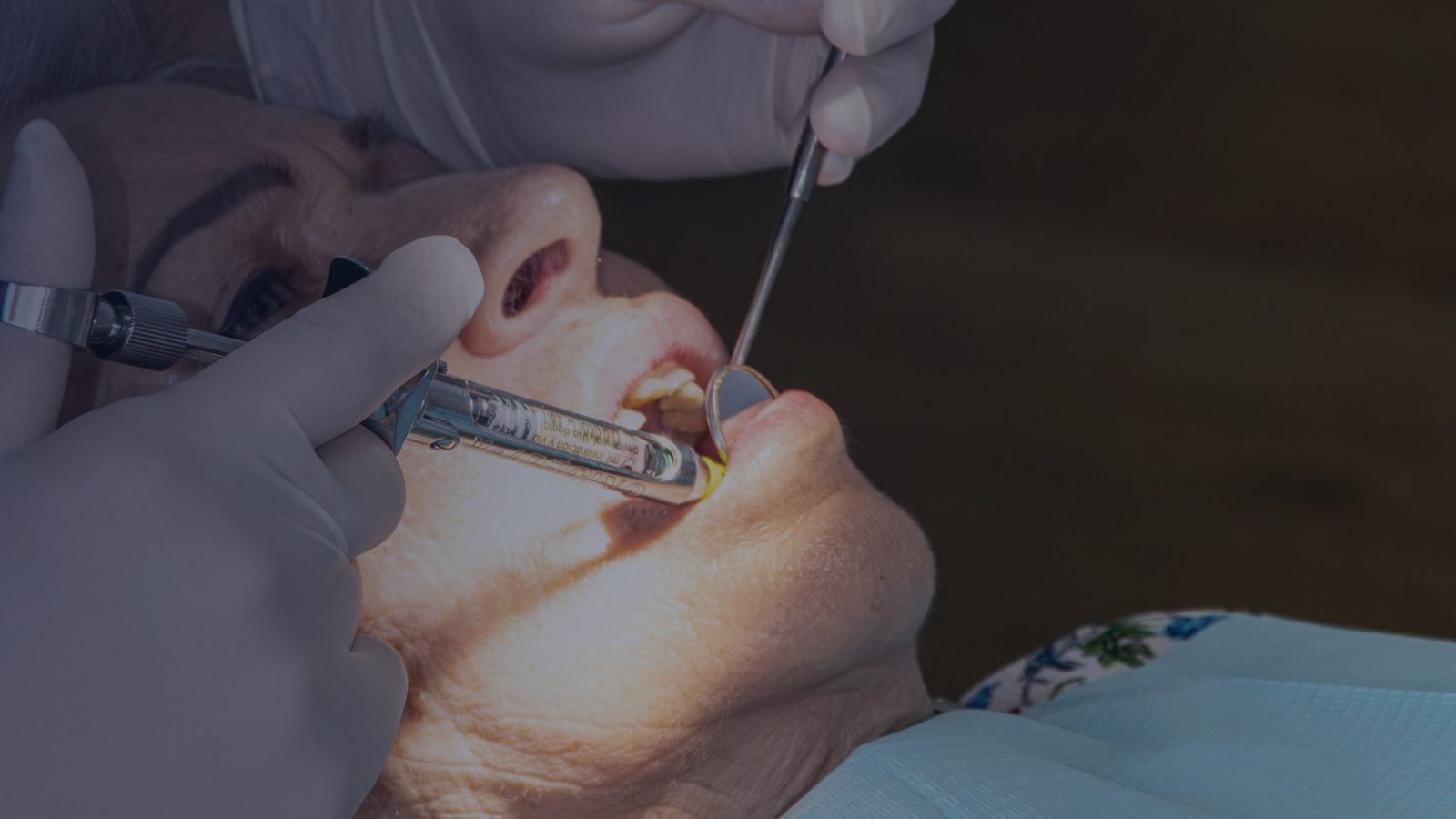 Endodoncia: qué es, cuándo se necesita y por qué no debería darte miedo