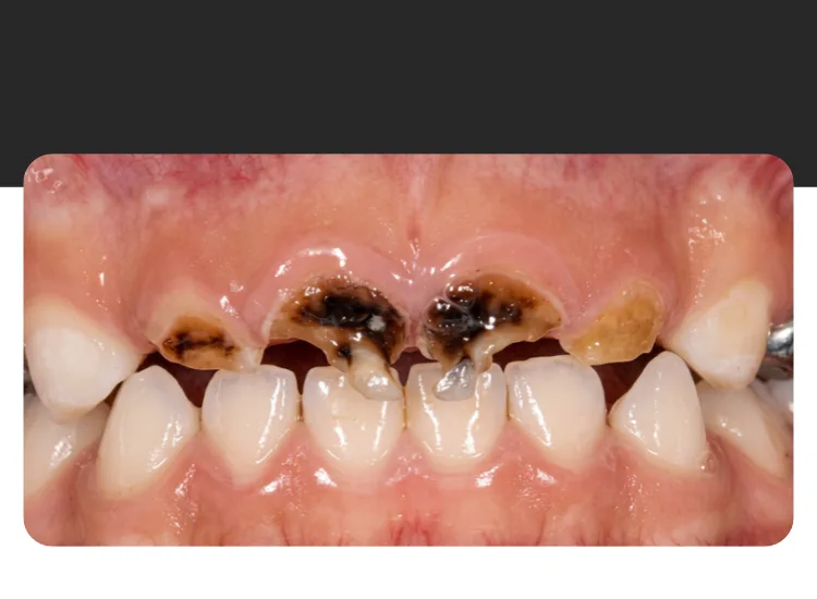 Niño sonriente en la consulta del dentista infantil
